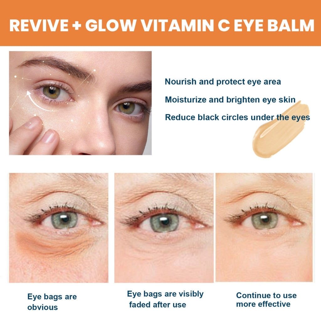cooling-hydrating-eye-balm-eye-balm-with-vitamin-c-solenya-skin