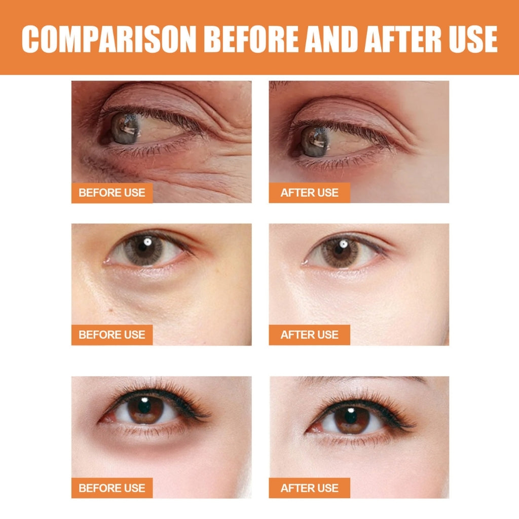de-puff-eye-balm-eye-balm-with-vitamin-c-solenya-skin
